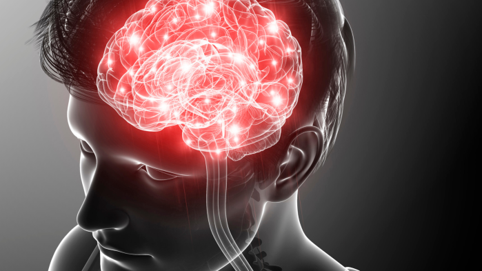 Stroke or TIA image.png